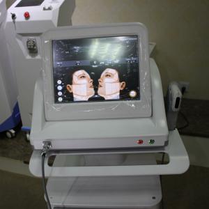 Quality high intensity focused ultrasound hifu machine for sale