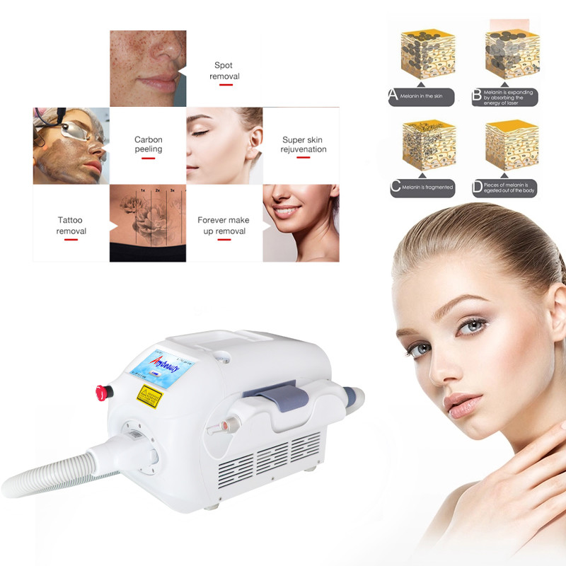 Buy cheap FDA 5NS Q Switched Nd Yag Laser Tattoo Removal from wholesalers