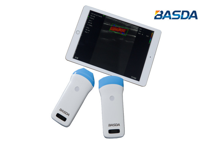 Quality WIFI Connect Medical Ultrasound Machine for sale