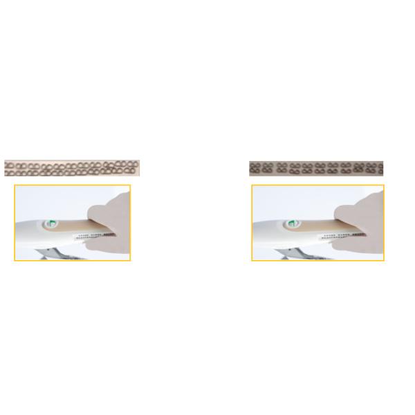 240 Vision Indicator Thoracic Surgery EEA Circular Stapler
