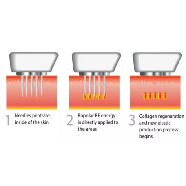 Multi Function RF Body Slimming Machine With Radio Frequency Fractional Treatment