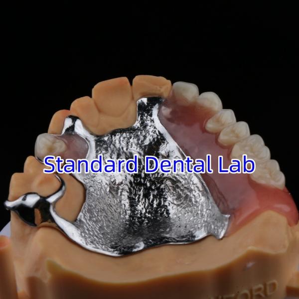 Upper Cast Framework Acrylic Metal Partial Dentures Strong Lightweight and Durable