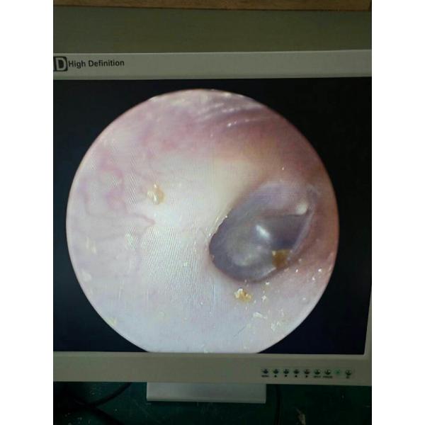 Medical Endoscopy Camera 700 Lines For ENT Rigid Endoscopes With C Mount Coupler
