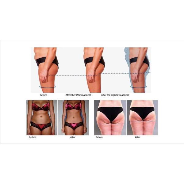 20A Portable EMS Sculpting Machine 300W - 4000W Muscle Sculpting Machine