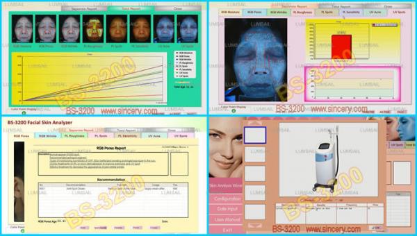 Portable 12 Mega Pixels Skin Analysis Machine , Skin Moisture Analyzer