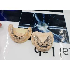 High Accuracy CAD-CAM Fixed Removable Bridge Digitization Design