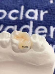Quality Dental Composite Inlays And Onlays Ivoclar Nexco High Esthetics for sale