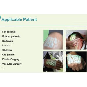 Injection Light Ems Health Analyzer Machine , Handheld Vein Locating Device