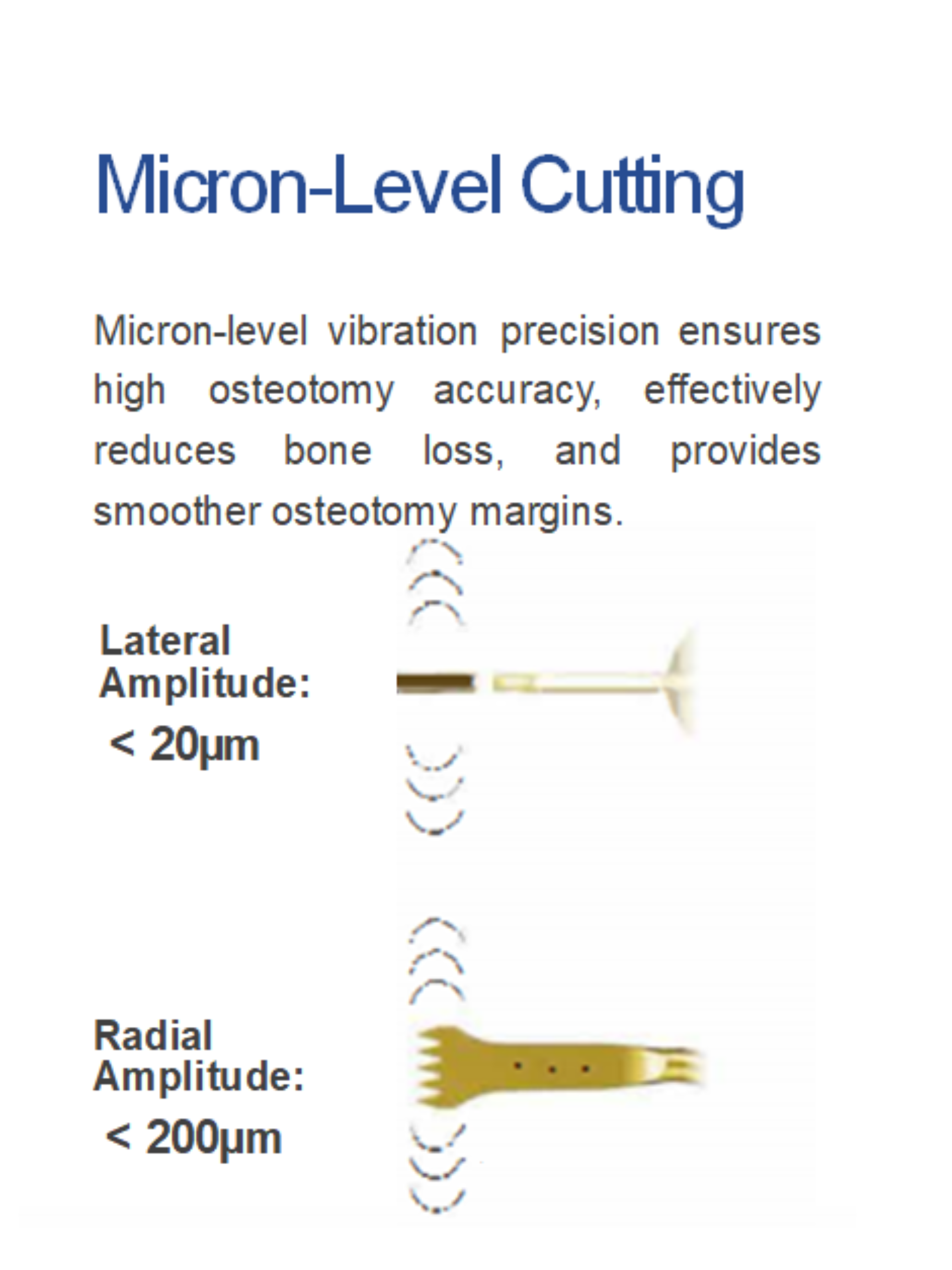 Ultrasonic Bone Scalpel: The Next Generation Tool for Safe and Precise Osteoplasty Procedures