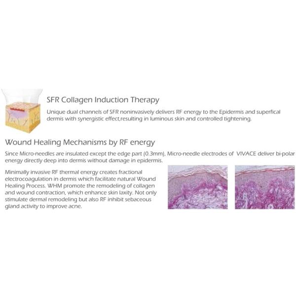 Fractional RF Microneedle radio frequency machine microneedle mesotherapy skin resurfacing rf microneedle machine