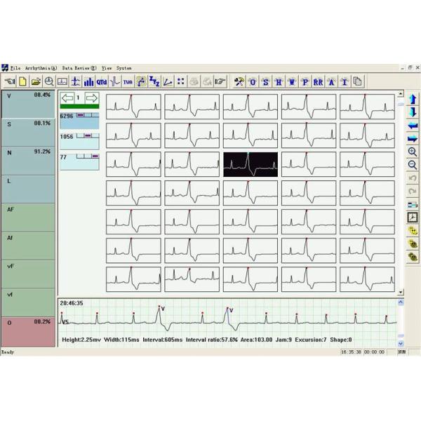 TLC6000 Dynamic ECG Systems 12 Lead ECG Holter Systems 48 Hours Recorder with Analysis Software
