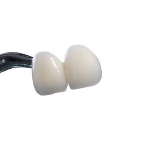 Quality Good Biocompatibility Zirconia Dental Crown Non Irritating Easy Cleaning for sale