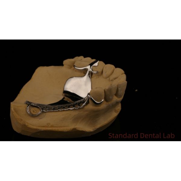 High Strength 3D Printed Cast Framework COCR Partial Dentures Chrome Cobalt Cast Metal Framework