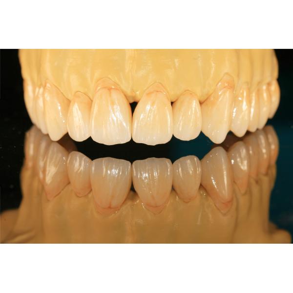 Porcelain Cubic Zirconia Teeth