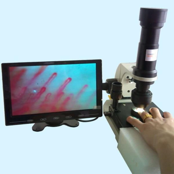 Accurate Color LCD Nailfold Capillary Microcirculation Microscope Device for Sub Health Checking