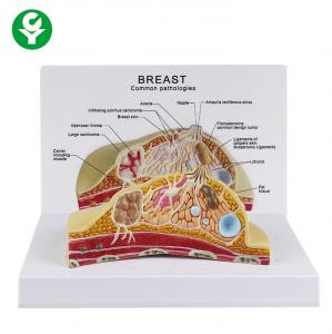 Quality Female Cross Section Breast Cancer Model Anatomical 1.0 Kg Single Gross Weight for sale