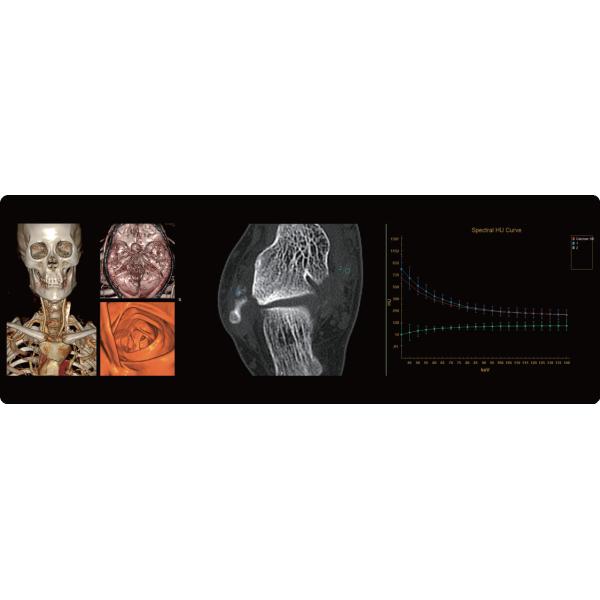 Premium Medical 128 Slice Computed Tomography System Imaging Scanner CT Scan Machine