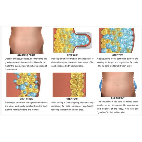 12V Cool Mini Fat Reduction Cryolipolysis Slimming Machine