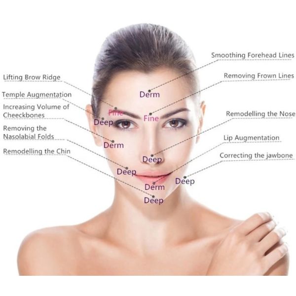 Fosyderm Wrinkle Removal Dermal Filler Injectable For Under Eye
