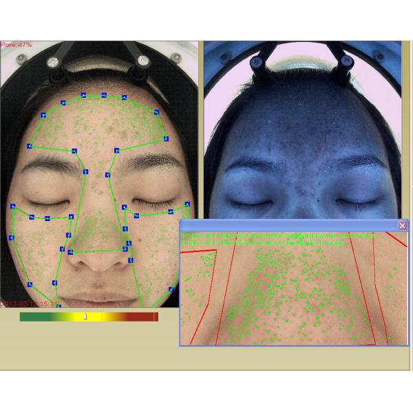 UV RGB 3d Facial Skin Analyzer Device Face Analyzer Machine