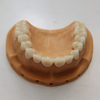 SHT Complete Zirconia System Blocks Staining Liquids and Protocols for Long