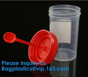 Quality Urine Container, Disposable Urine Collector Urine Specimen Container,Urine Specimen Cup,Sterile or Non Sterile for sale