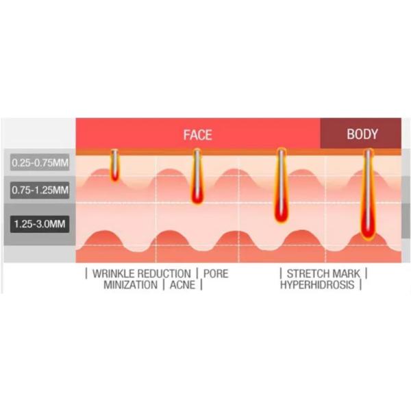 Multi Function RF Body Slimming Machine With Radio Frequency Fractional Treatment