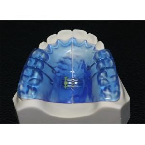 Orthopedic Dental Instruments With High Stability And Good Biocompatibility