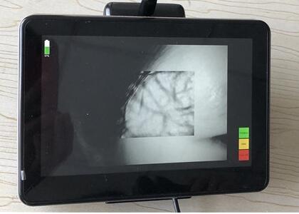 2 Million Pixels Infrared Camera Portable Infrared Vein Finder Vascular Detector Without Radiation