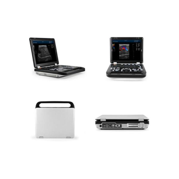 Notebook Laptop Ultrasound Scanner Color Doppler Machie With 15'' LED Monitor
