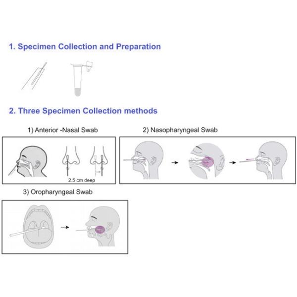 Greenspring Covid 19 Antigen Swab Test Kit 10 Tests/Kit CE Sensitivity 98%