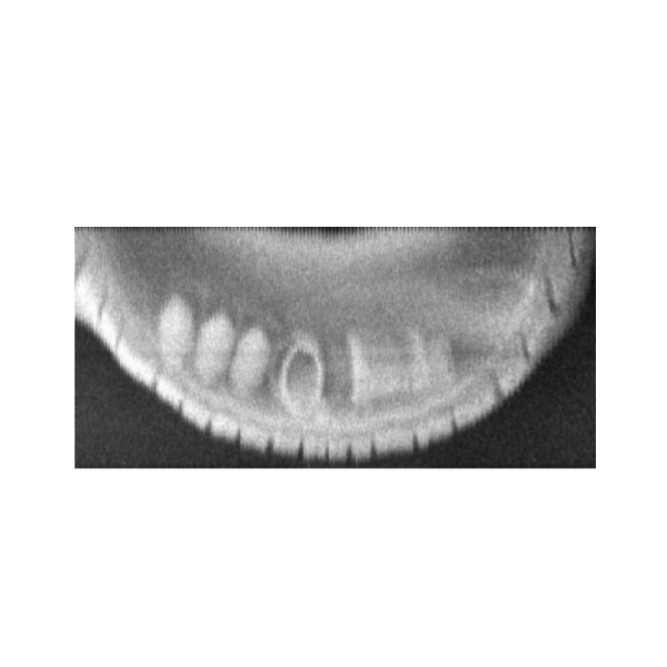 Handheld X-ray Backscatter Real Time Imaging System