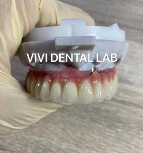 Quality Scheftner Ivoclar Porcelain Fused Metal Crowns Dental SLM Technique for sale