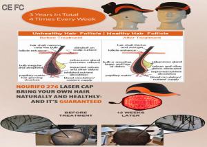 Quality Hair Loss System Helmet Cold Laser Hair Growth Cap for Hair Growth Faster for sale