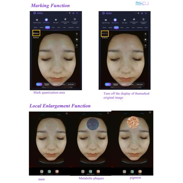 Customized Automatic 3D Skin Analysis Machine For Pigmentation And Acne Analysis