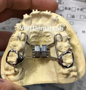 Quality High Esthetics Dental Hyrax Orthodontic Expander Good Fit FDA Certificated for sale