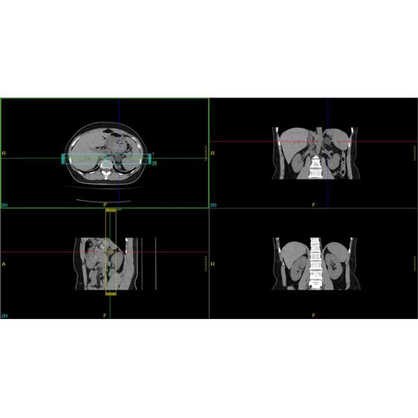 Premium Medical 128 Slice Computed Tomography System Imaging Scanner CT Scan Machine